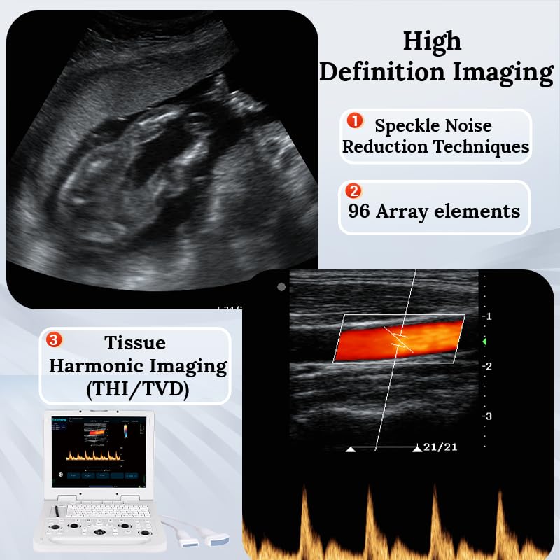 S-CU3 Full Digital Laptop Color Doppler Ultrasound System Veterinary 15" HD